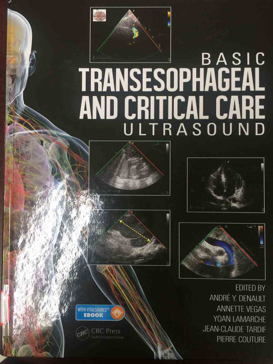《Basic Transesophageal and Critical Care Ultrasound》
