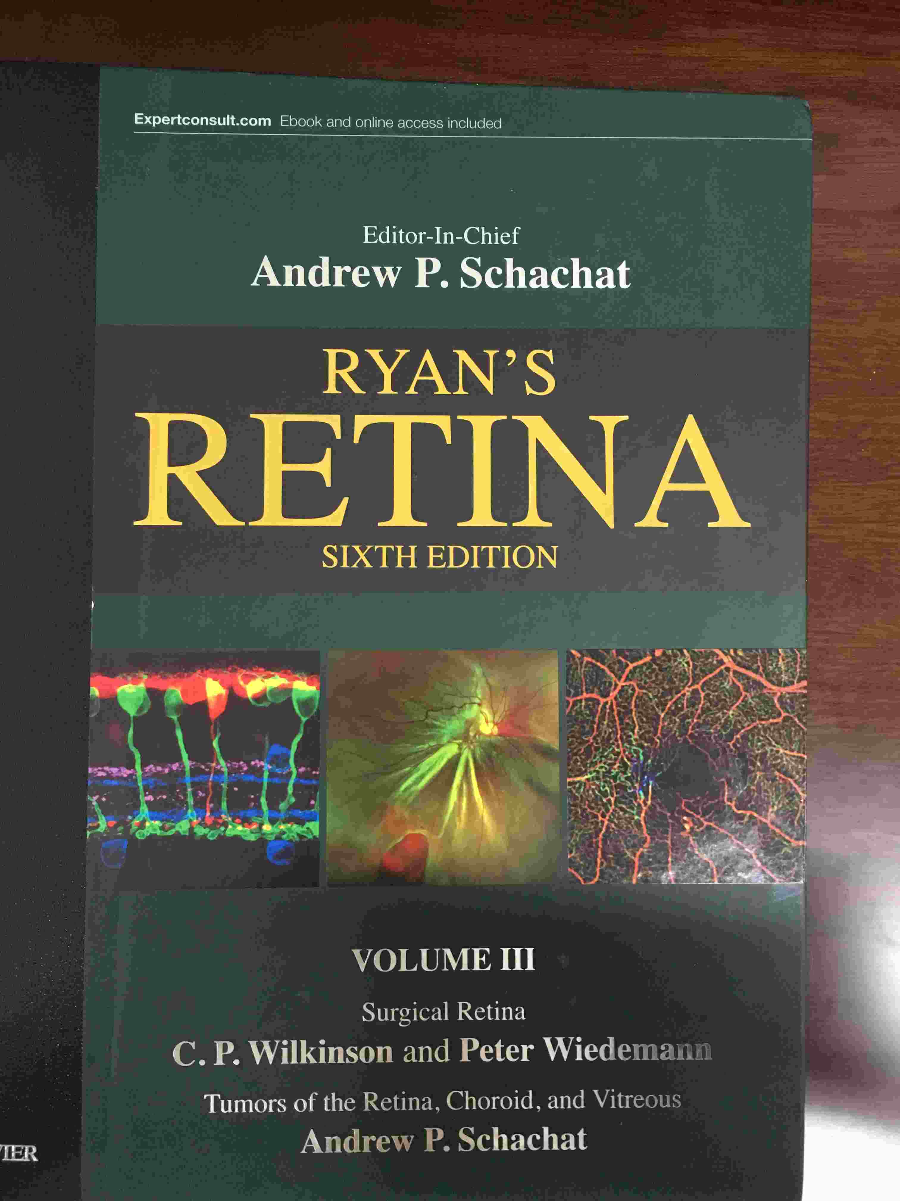 «Ryan's Retina»