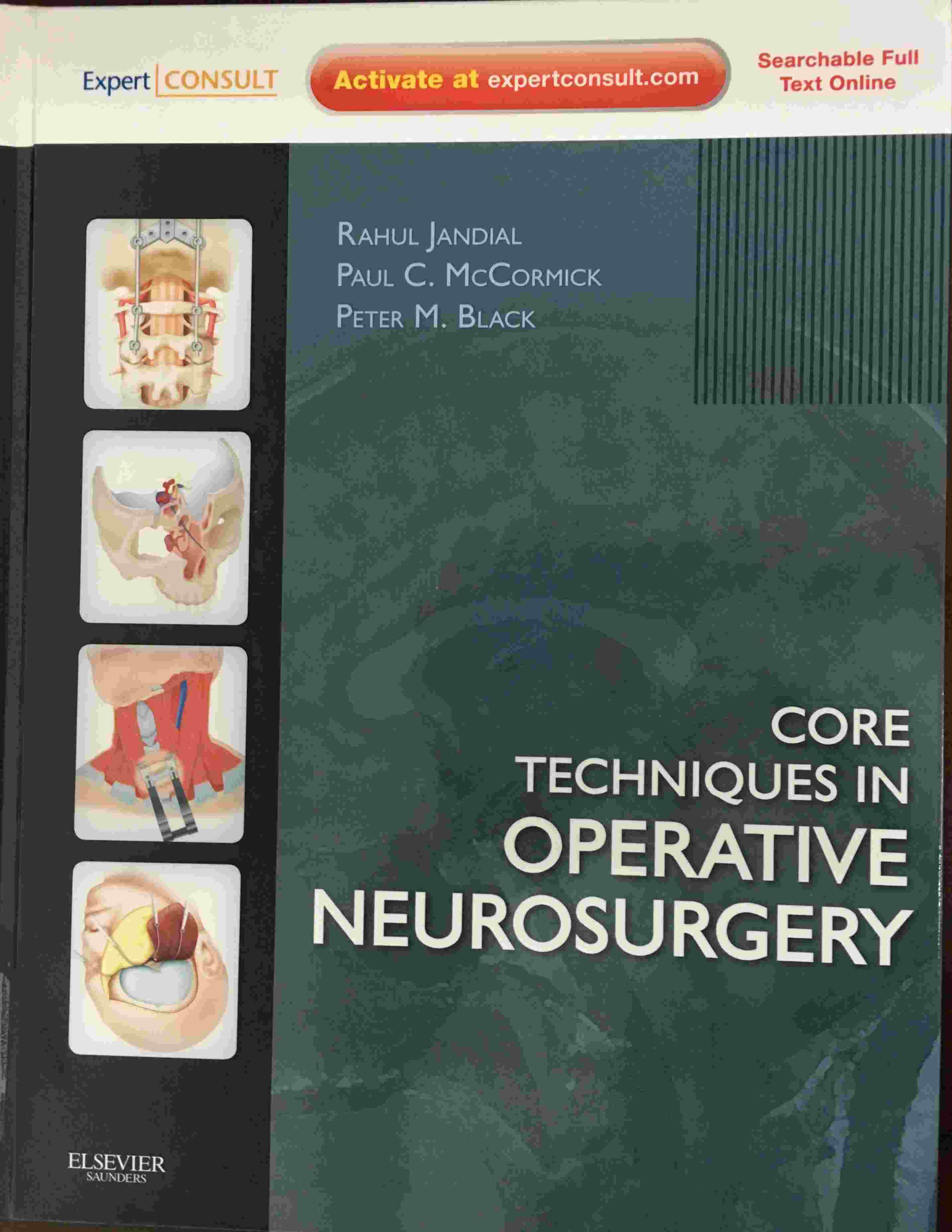 «Core Techniques in Operative Neurosurgery »
