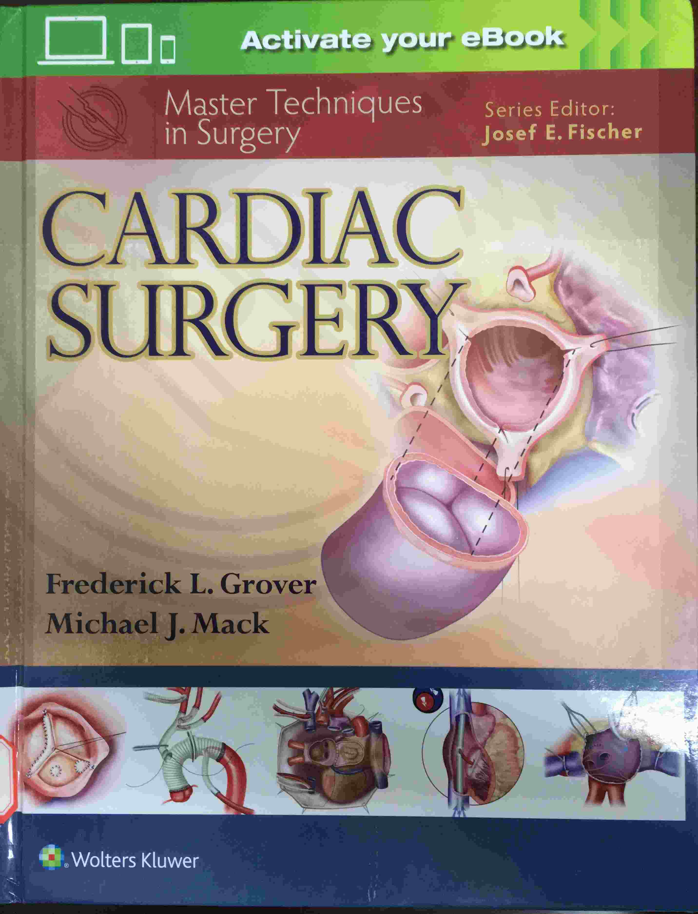 « Master Techniques in Surgery: Cardiac Surgery »