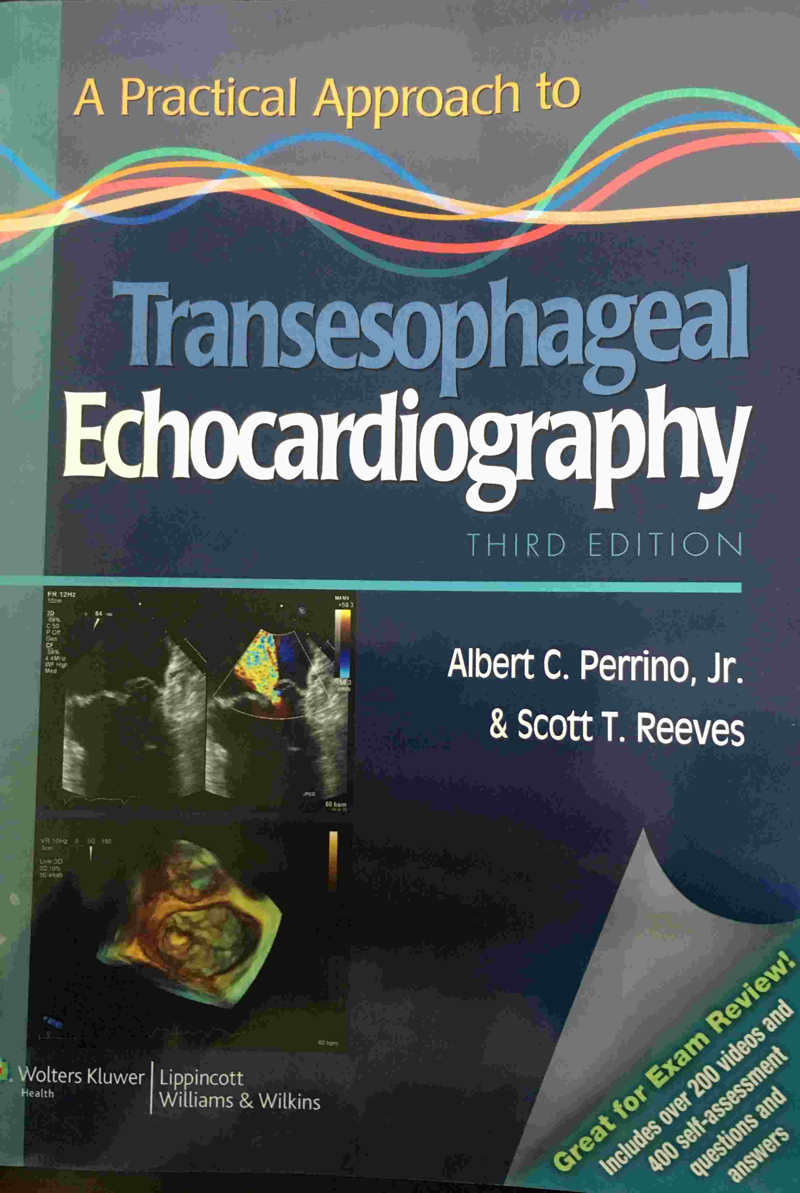 «A Practical Approach to Transesophageal Echocardiography»