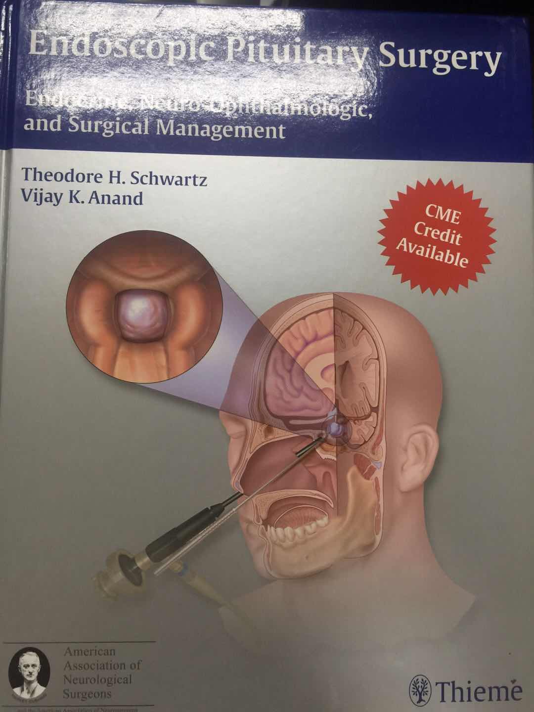 《Endoscopic Pituitary Surgery: Endocrine, Neuro-Ophthalmologic, and Surgical Management》