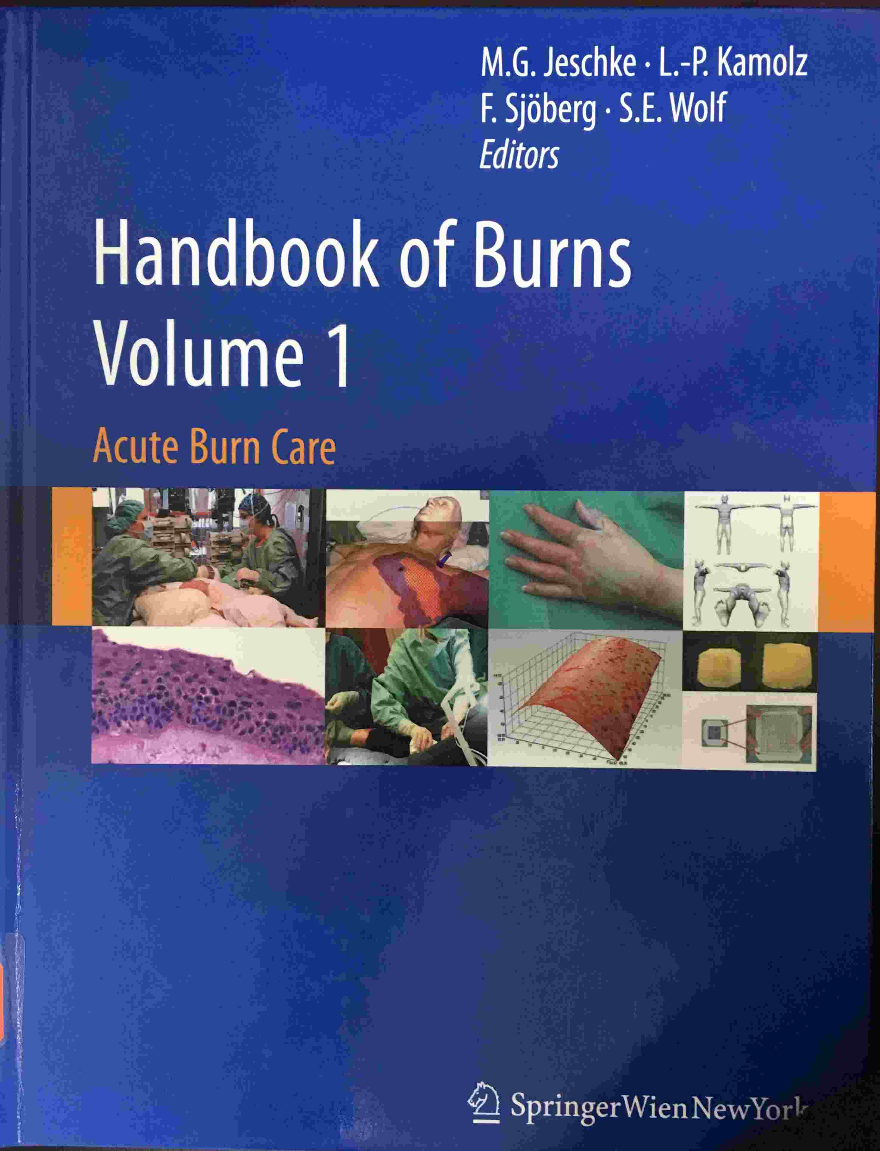 «Handbook of Burns：Acute Burn Care ＆Reconstruction and Rehabilitation»