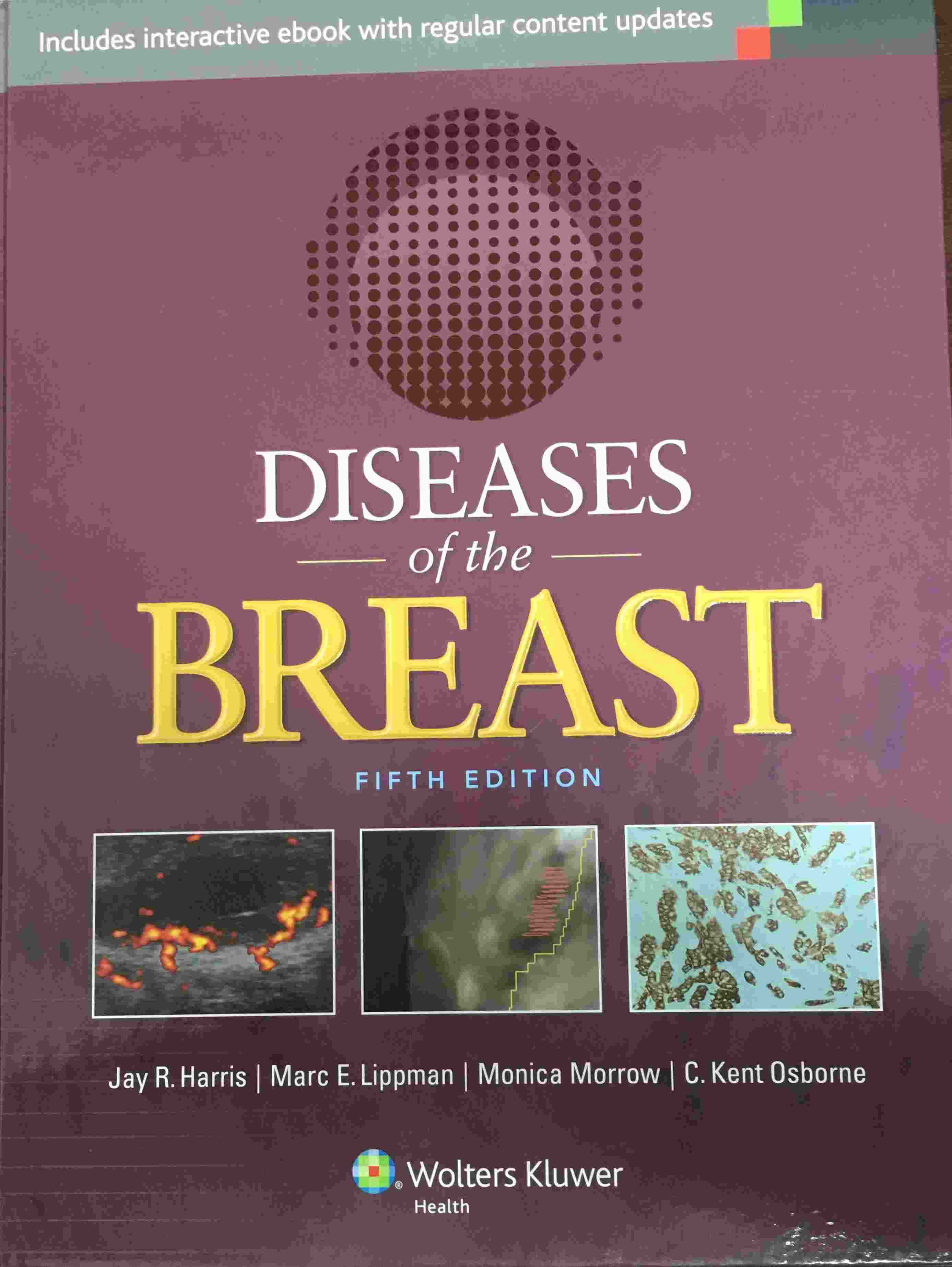 «Diseases of the Breast »